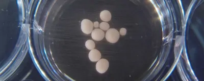 Mini-brain organoids